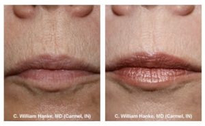 cosmetic dermatology before and after treatment