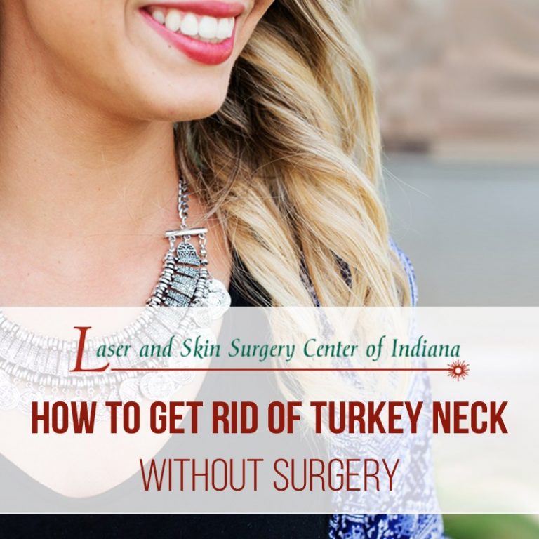 non-surgical turkey neck lift indianapolis