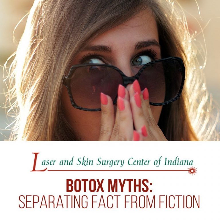 botox myths