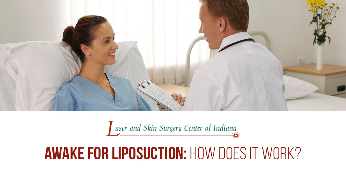 Awake for Liposuction? Tumescent Liposuction Safety Laser and Skin