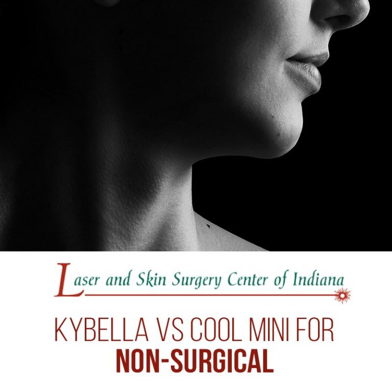 kybella vs cool mini indianapolis