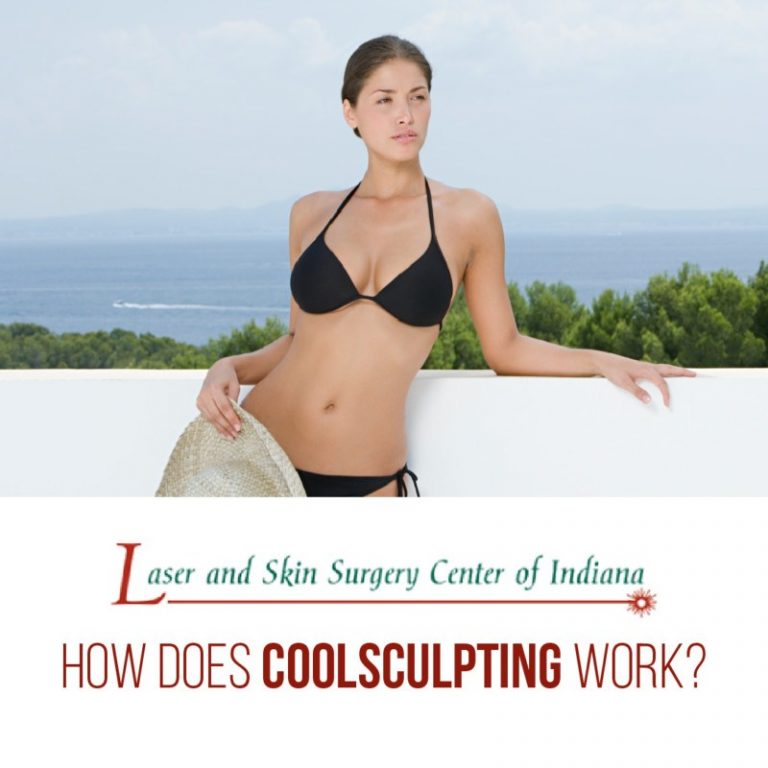 how does coolsculpting work