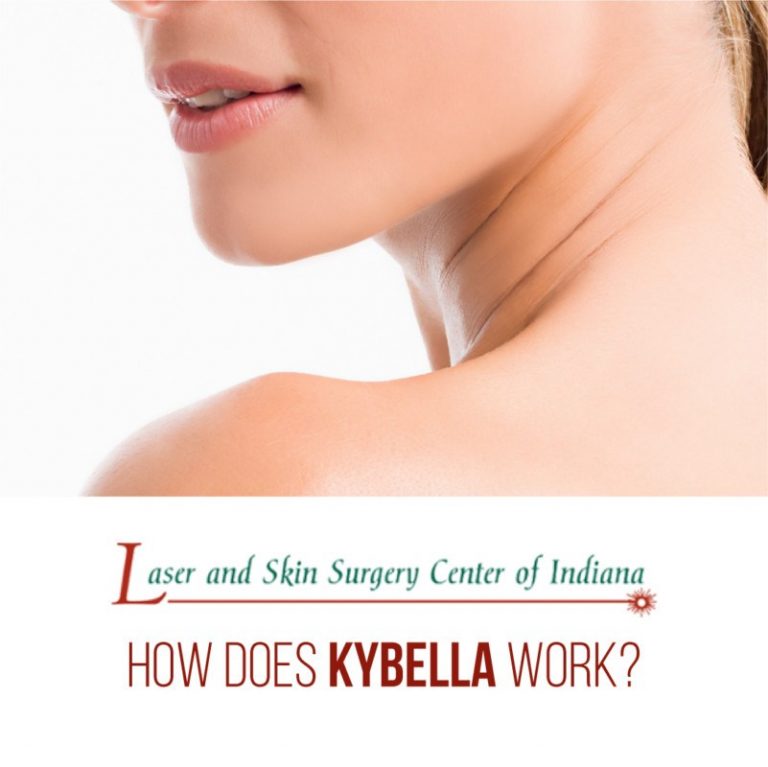 how does kybella work