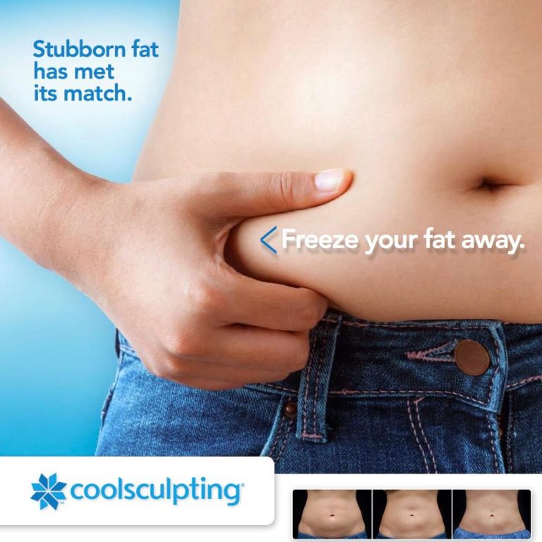 does coolsculpting work