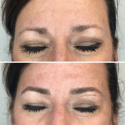 before and after microblading eyebrows