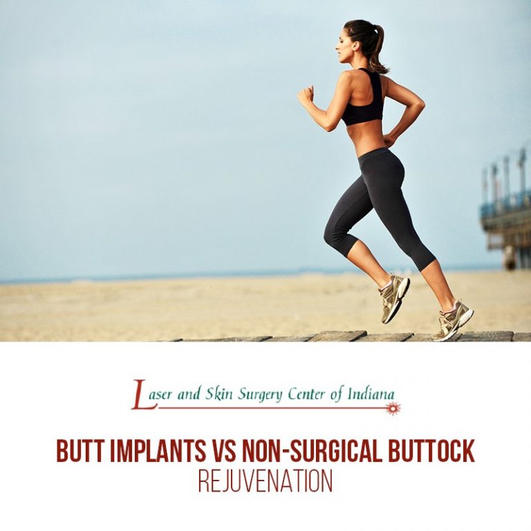 butt implants vs buttock reshaping