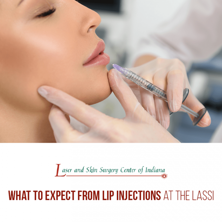 lip injections indianapolis