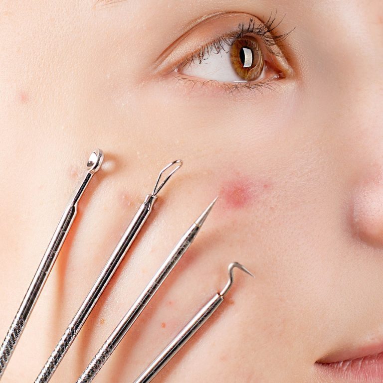 pimple popping tools