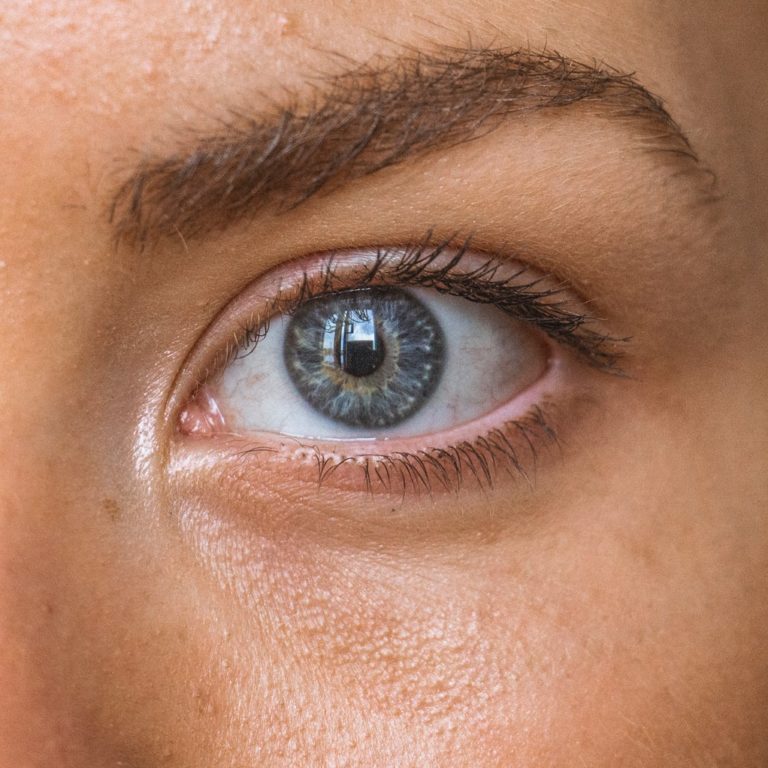under eye