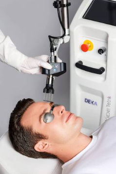 coolpeel laser treatment indianapolis