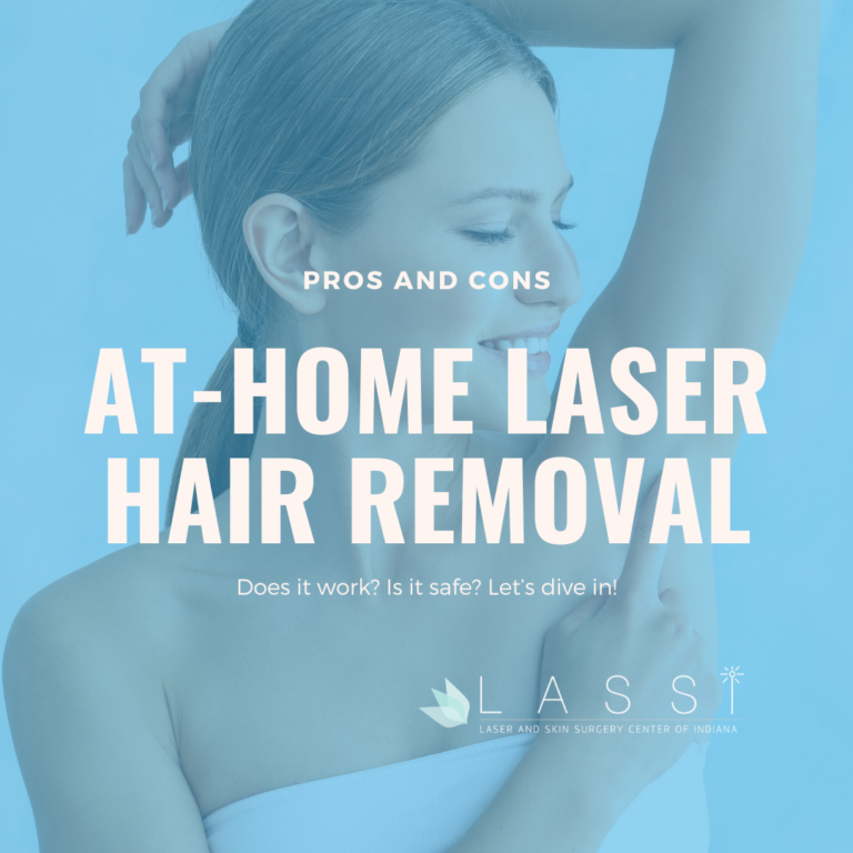laser hair removal at home