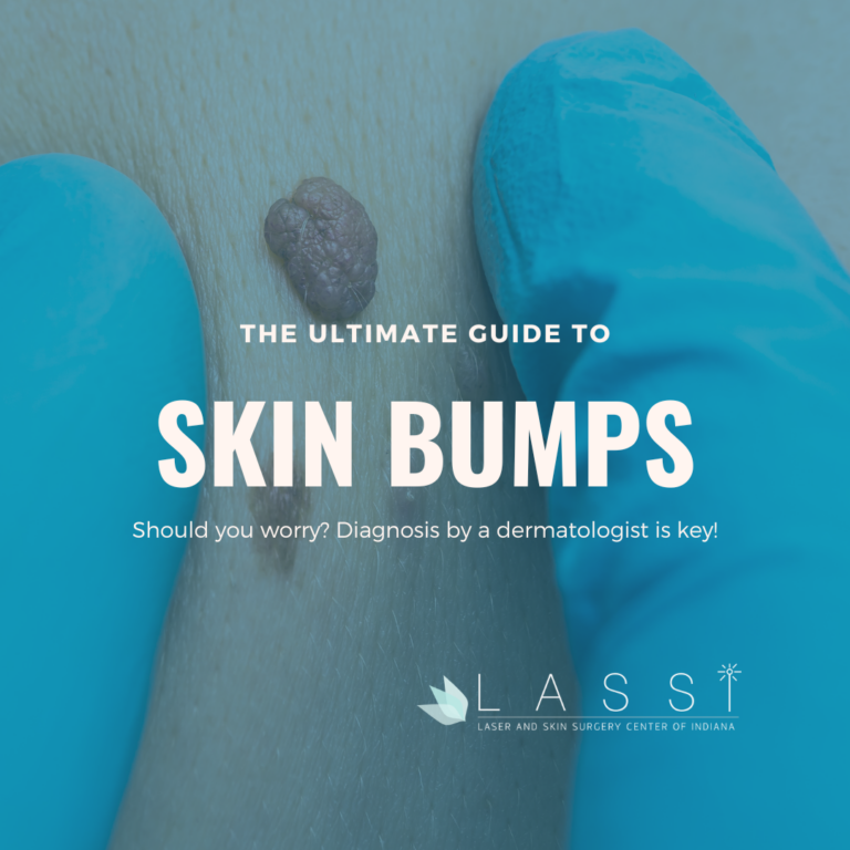 skin bumps indianapolis