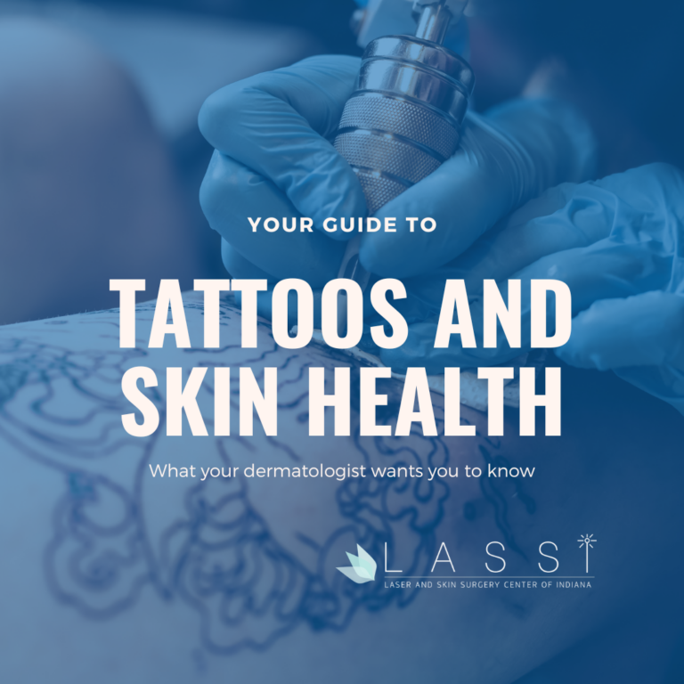tattoos indianapolis dermatologist