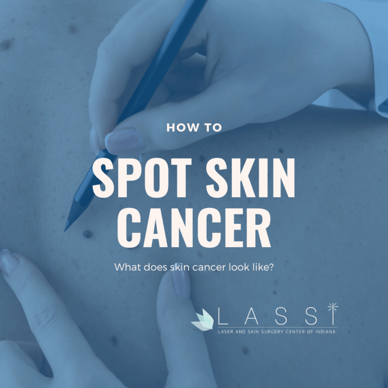 What does skin cancer look like?