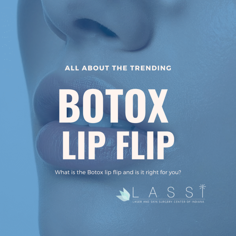 photo of woman with beautiful lips after a botox lip flip in indianapolis
