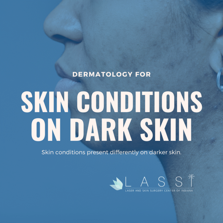woman with dark skin and undiagnosed skin condition