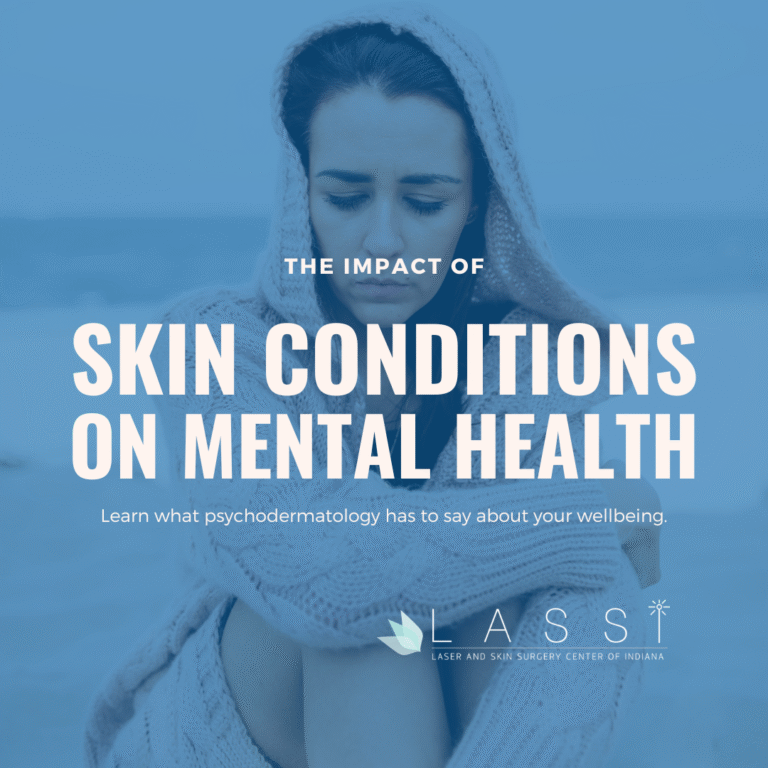 sad woman wearing a hoodie with poor mental health due to dermatologic condition