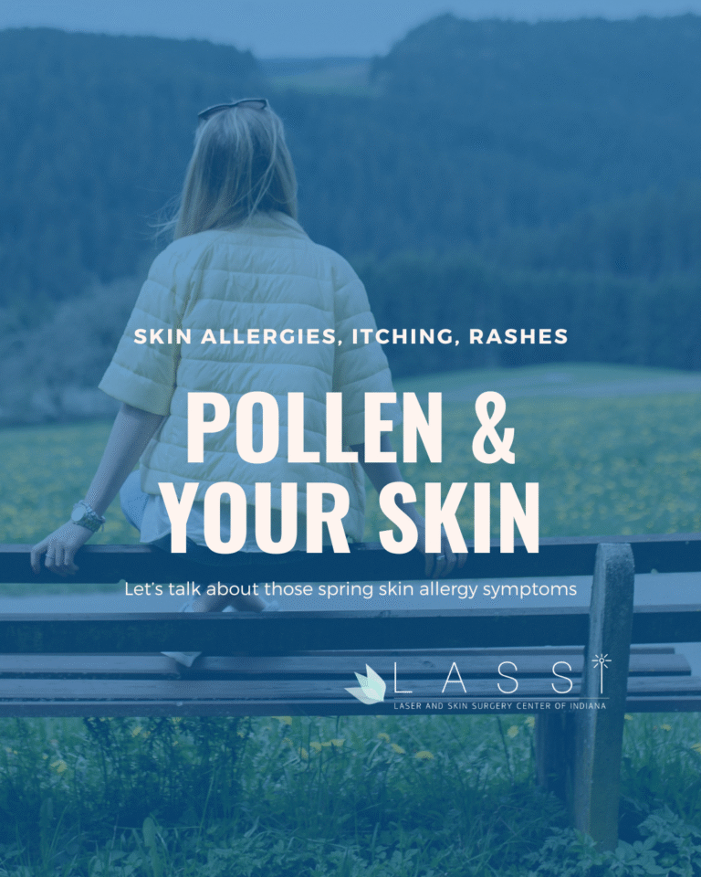 graphic of a woman sitting on a bench, with text that reads Pollen and Your Skin Allergies